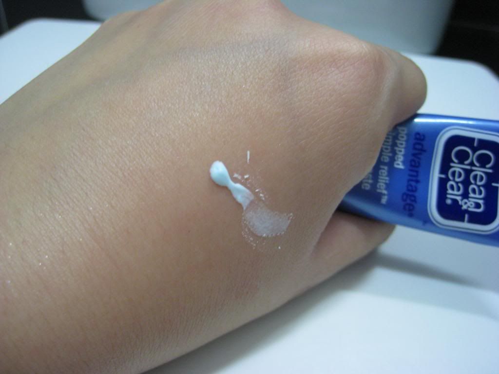 Beauty Blog Clean and Clear Advantage popped pimple relief drying paste